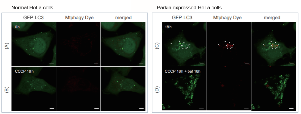 Comparison with Autophagy Marker