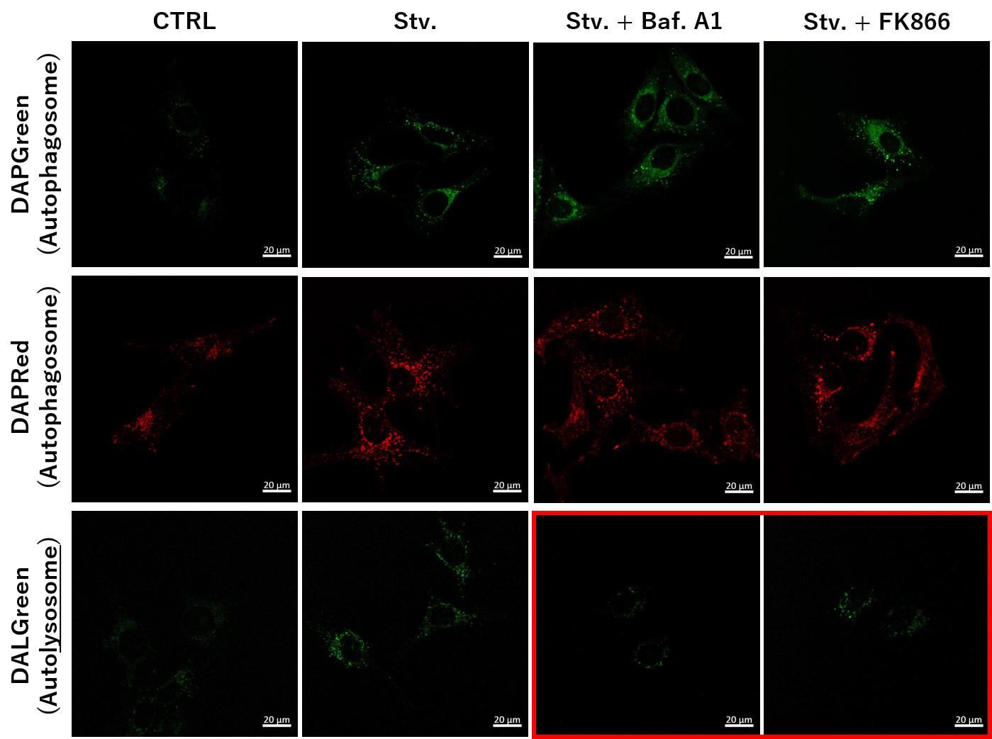 Dojindo application note image comparing autophagosome and autolysosome signals under starvation, FK866, and Bafilomycin A1 treatments
