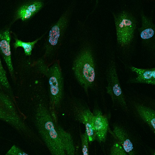 SPiDER-βGal, γ-H2AX and DAPI co-staining in fixed cells